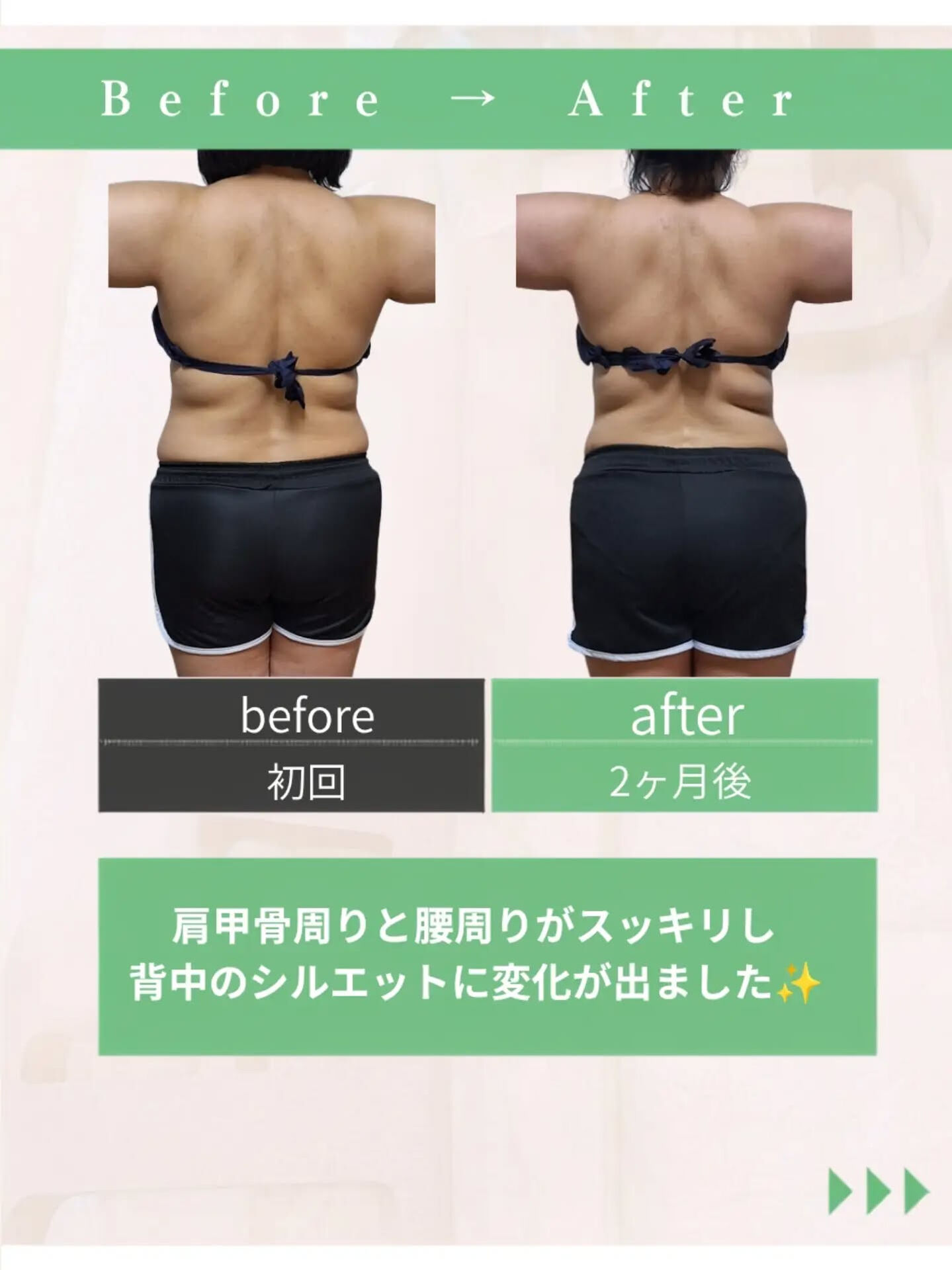\何をやっても痩せない⋯/それ努力不足じゃないんです！